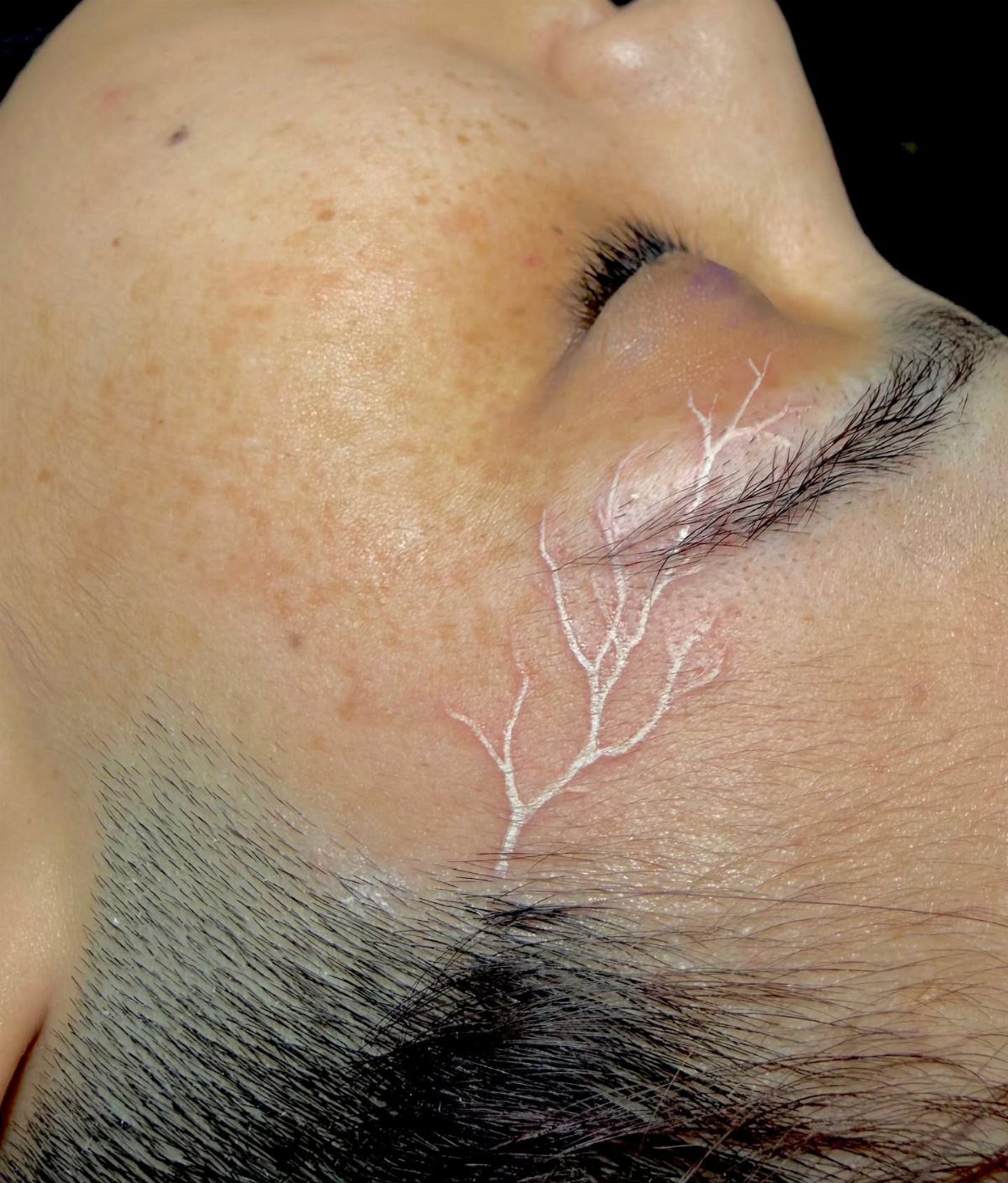 White ink lightning bolt tattoo on a man's temple and cheek area.